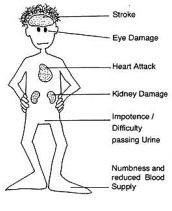 diabetes treatment